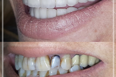 Dental Aesthetic 1