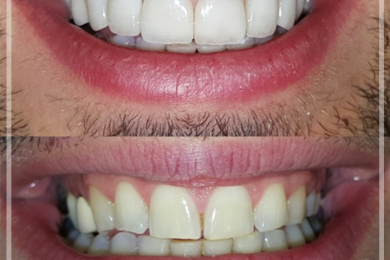 Dental Aesthetic 2