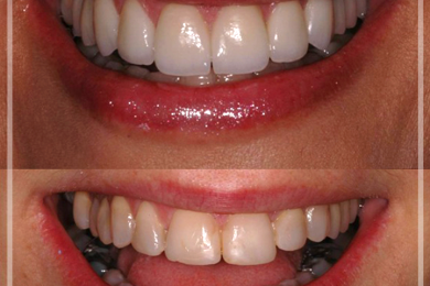 Dental Aesthetic 3