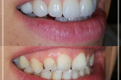 Dental Aesthetic 4