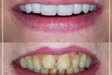 Dental Aesthetic 5