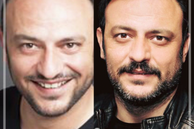 Hair Transplant 4