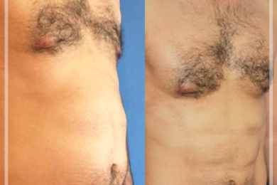 Six-Pack Operation 2
